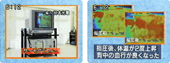 サーモグラフィー
